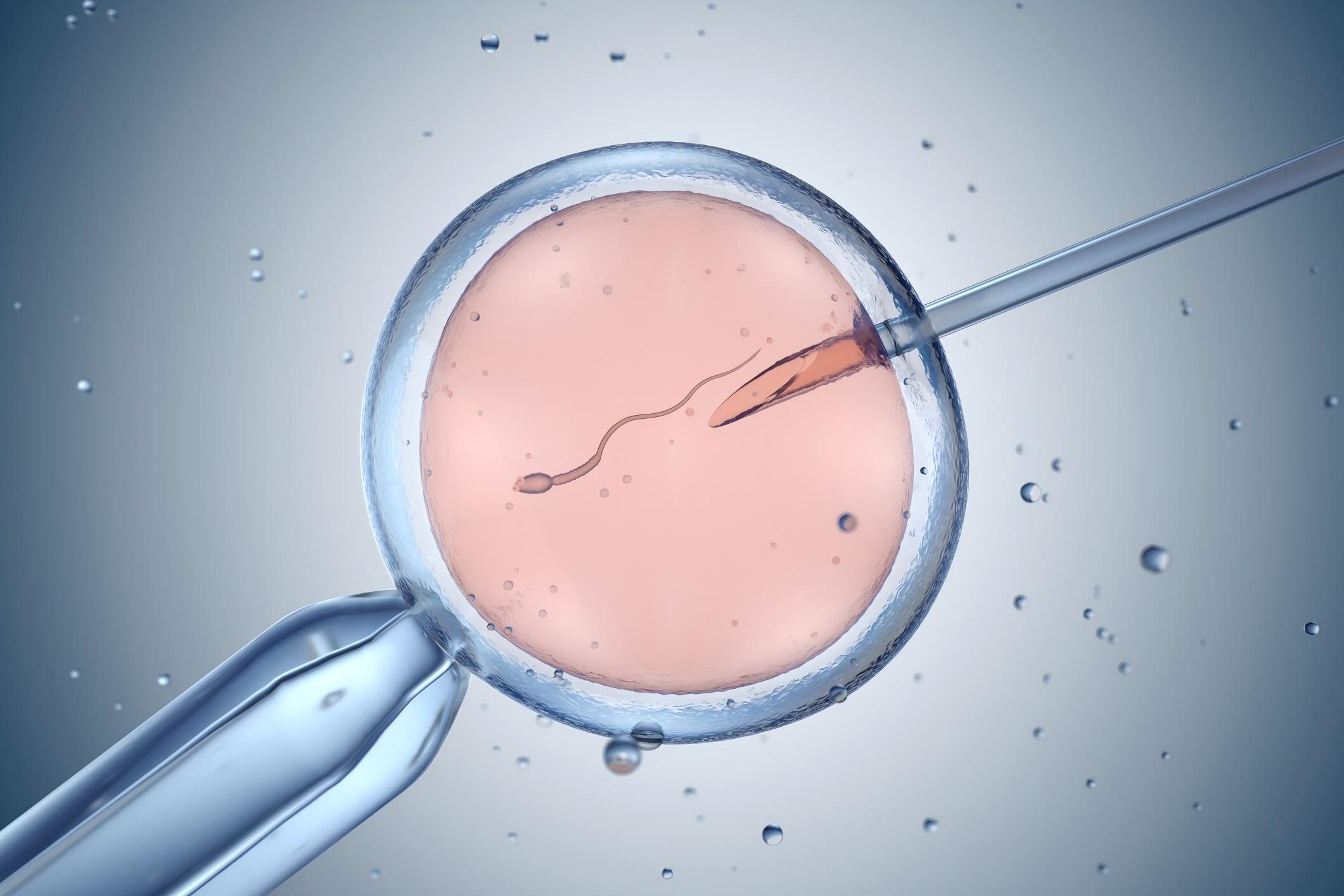 IVF Treatment